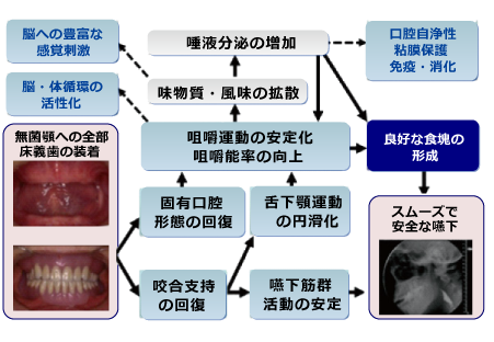 義歯診療科紹介/新潟大学 大学院医歯学総合研究科 包括歯科補綴学分野